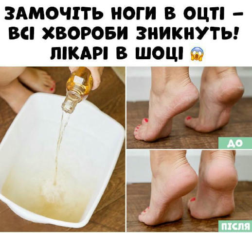Замочіть ноги в оцті один раз на тиждень і побачите, як зникають усі ваші хвороби! Результат вже після першого застосування. 